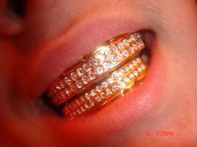 bling_teeth_17.jpg