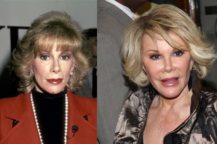 joan-rivers-before-after.jpg