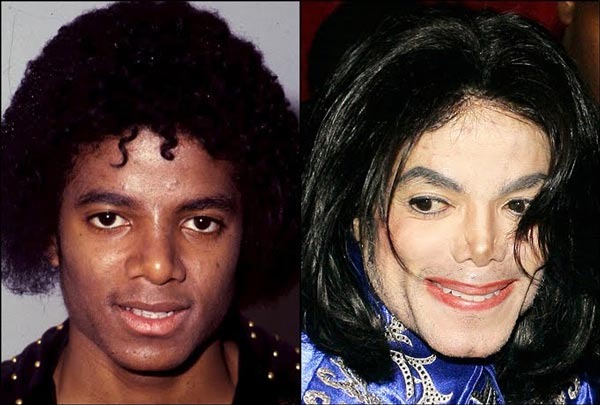 michael-jackson-plastic-surgery-before-after_zpsp2oxjovh.jpg