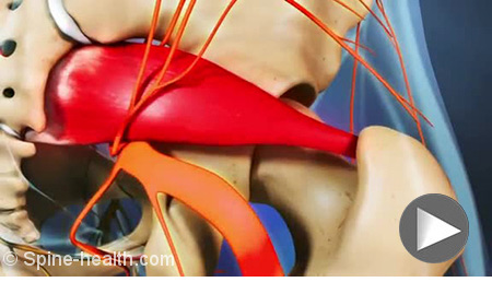 piriformis-syndrome-with-sciatic-nerve-compression.jpg
