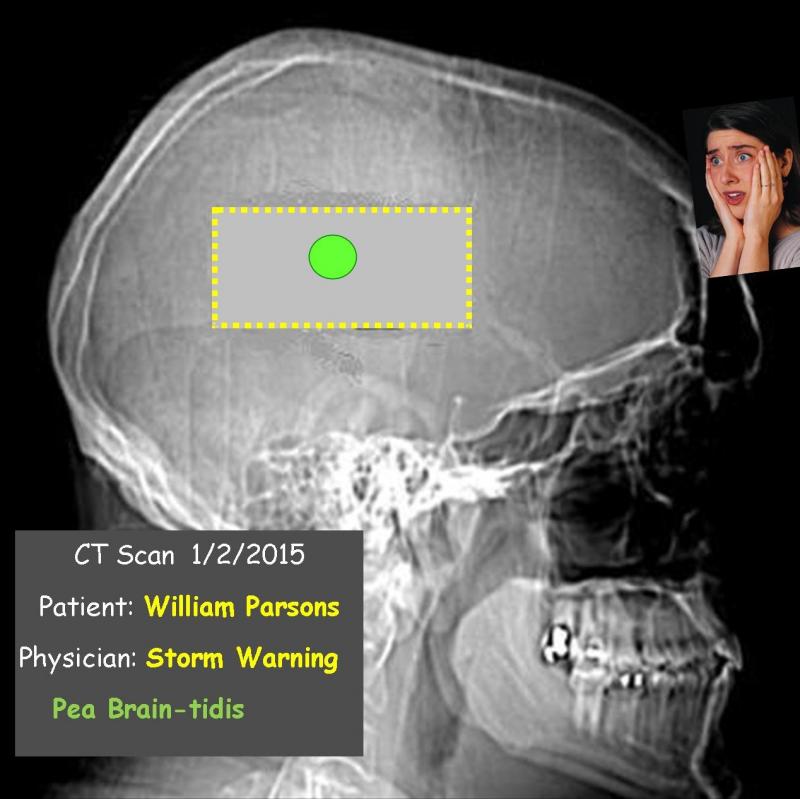 Willysbrain_zps8cf06671.jpg